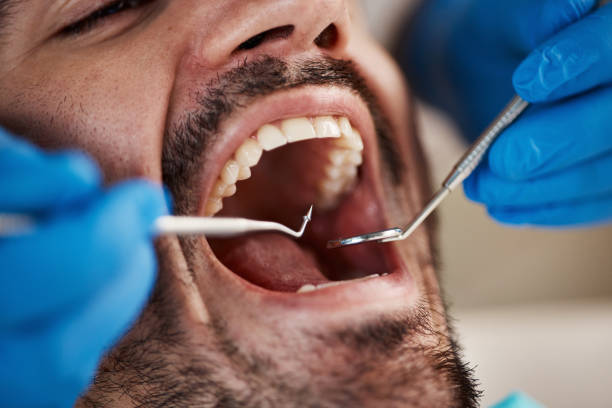 Best Dentist for Tooth Abscess  in Lake Andes, SD