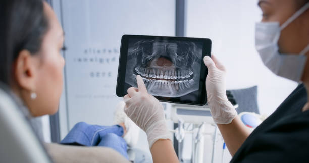 Teeth Whitening in SD
